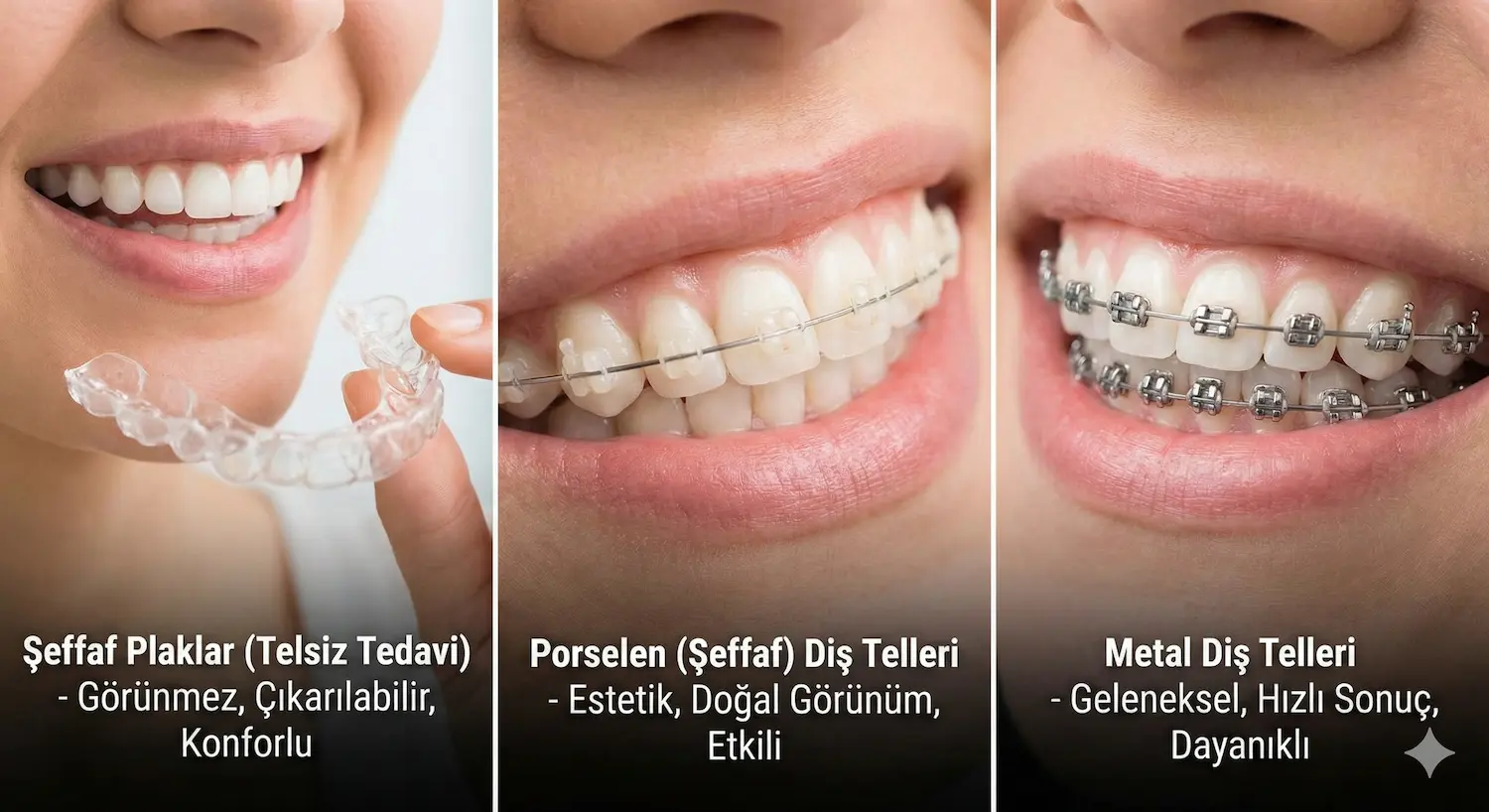 Şeffaf Plak ve Diş Teli Tedavisi